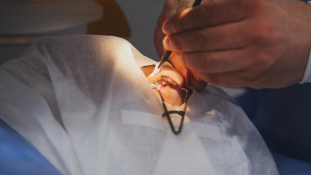 The Best Age to Get LASIK Eye Surgery—Refractive Errors, Age Limits 2 lasik laser correction for better vision