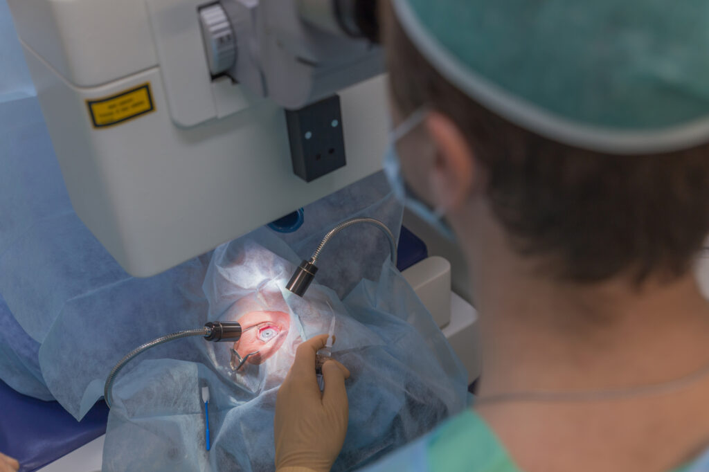 Is LASIK Safe for Farsightedness? Here’s What to Expect 4 LASIK ophtalmology operation for farsightedness