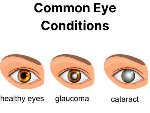 Lens Replacement Surgery 5 Refractive errors common eye conditions edited